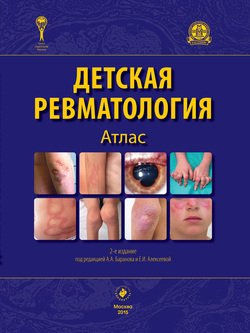 Детская ревматология. Атлас