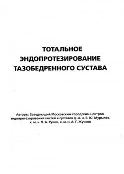 Тотальное эндопротезирование тазобедренного сустава