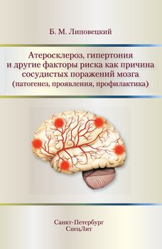 Атеросклероз, гипертония и другие факторы риска как причина сосудистых поражений мозга