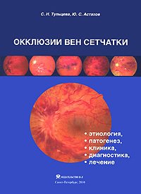 Окклюзии вен сетчатки 