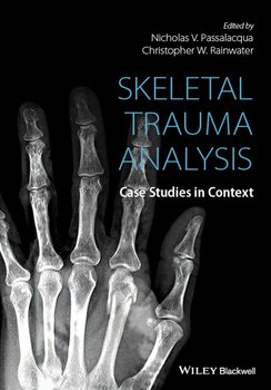 Skeletal Trauma Analysis. Case Studies in Context