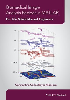 Biomedical Image Analysis Recipes in MATLAB. For Life Scientists and Engineers